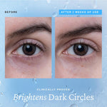 Load image into Gallery viewer, Belif Aqua Eye Gel 15ml