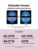 Load image into Gallery viewer, Cosrx the Niacinamide 15 Serum 20ml