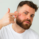 Load image into Gallery viewer, BKIND Refining Face Serum with Niacinamide & Witch Hazel Water