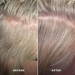 Load image into Gallery viewer, Everboost Multi-Peptide Scalp Serum