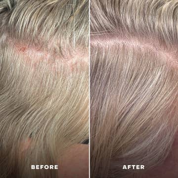 Everboost Multi-Peptide Scalp Serum
