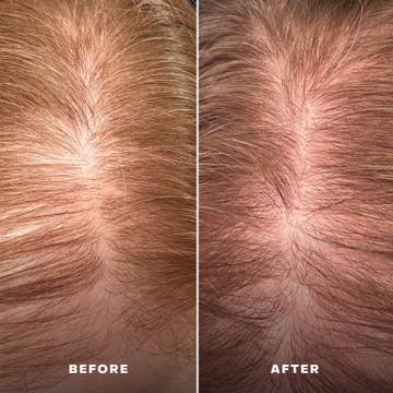 Everboost Multi-Peptide Scalp Serum